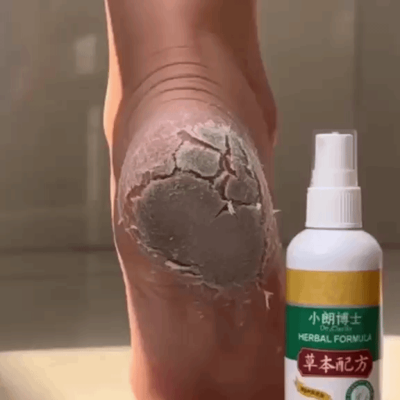 Spray Revitalizant pentru Picioare cu Extracte din Plante – Piele Fină și Îngrijită